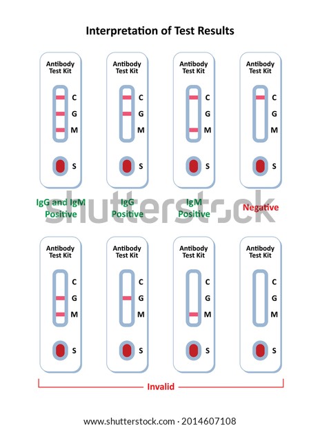 Interpretation Test Results Antibodies Test Kit Stock Vector Royalty Free 2014607108 5739