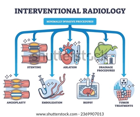 Interventional radiology as minimally invasive procedures outline diagram. Labeled educational scheme with medical biopsy treatment process for tumors, stenting and angioplasty vector illustration.
