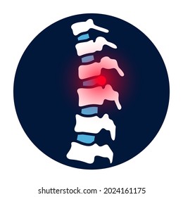 Intervertebral hernia logo. Spine disease, backbone with herniated disc, therapy and treatment in spine clinic. Spinal pain and diagnosis. Human vertebrae anatomy isolated medical vector illustration.