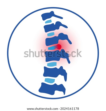 Intervertebral hernia logo. Spine disease, backbone with herniated disc, therapy and treatment in spine clinic. Spinal pain and diagnosis. Human vertebrae anatomy isolated medical vector illustration.