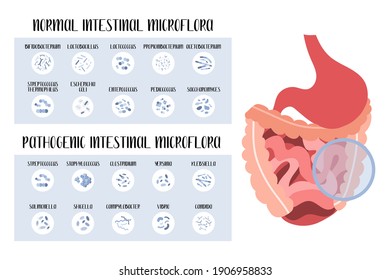 Intestinal microflora. Normal and pathogenic bacteria for stomach, gut, intestine. Good and bad microorganism. Microbiome. Vector flat cartoon illustration. Perfect for flyer, medical brochure, banner