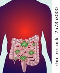 Intestinal virus infection.