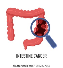 Intestine cancer disease concept vector illustration on white background.