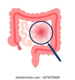 Intestine Pain Or Inflammation. Bowel, Appendix, Rectum And Colon Anatomy Poster. Cancer In Human Body. Digestive System Disease. Medical Exam, Laboratory Research. Isolated Flat Vector Illustration.