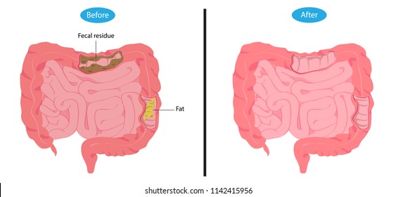 The intestines are clean and not clean