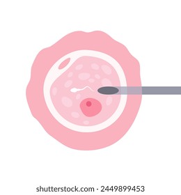 Intracytoplasmic sperm injection (ICSI). Intracytoplasmic sperm injection, ICSI, as part of IVF process