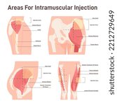 Intramuscular injection areas. Guide to injecting medication into muscle. Sites with large, easy-to-locate muscles and little fatty tissue, upper arm, thigh, hip and buttock. Flat vector illustration