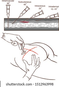 Intramuscular injection vector illustration and   Comparison of the angles of intramuscular injection.