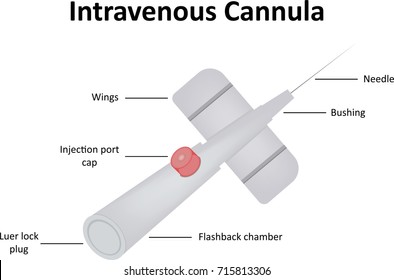 Intravenous Cannula