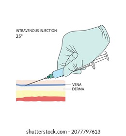 Inyección intravenosa. Métodos eficaces de administración de medicamentos y otras soluciones médicas que se utilizan en seres humanos y animales. Ilustración vectorial aislada en fondo blanco.
