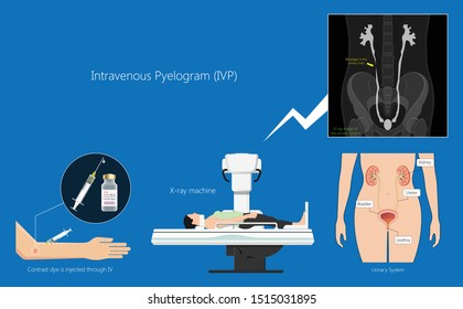 Intravenous pyelogram IVP exam diagnose treat ionizing symptom urine CT scan excretory urogram urologist urethra problem diagnostic blocked