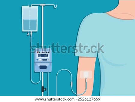 Intravenous therapy or IV therapy is a medical technique that administers fluids, medications and nutrients directly into a vein.Medical Infusion Pump IV Intravenous,Intermittent infusion, vector