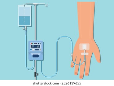 La terapia intravenosa es una técnica médica que administra líquidos, medicamentos y nutrientes directamente en una vena, terapia intravenosa, bomba de infusión médica IV intravenosa, infusión intermitente, Vector