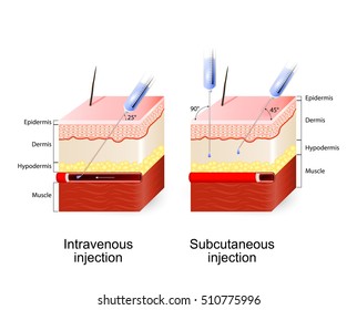 Subcutaneous Injection Images, Stock Photos & Vectors | Shutterstock