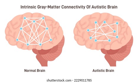 Intrinsic gray-matter connectivity of autistic brain. Neurodevelopmental condition with atypical brain connectivity and electrical activity. Flat vector illustration