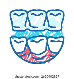 invisalign treatment doodle icon sketch vector. invisalign treatment sign. isolated symbol illustration