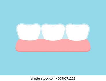 Invisible braces bracket on tooth in gum. Dental invisalign braces on white tooth orthodontic correction treatment concept. Vector flat design tooth dentistry clip art illustration.