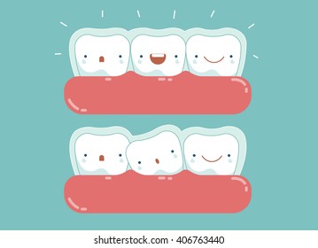 Invisible braces ,dental and tooth concept