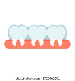 Invisible braces for oral teeth correction. Orthodontic, stomatology concept stock vector illustration. Equipment, object with teth and gum isolated on white background.