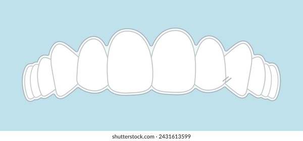 invisible braces, orthodontic, oral care treatment - flat illustration 