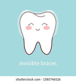 Invisible braces for teeth. Silicone trainer on cartoon teeth on blue background. Cute character for advertising transparent bracket in dental clinic. Vector stock illustration.