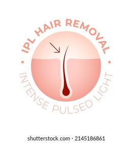 IPL Laser Hair Removal Verctor Illustration Concept