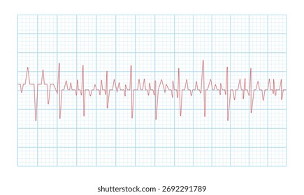 Forma de onda de ECG de batimento cardíaco irregular em papel de grade