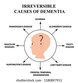 Irreversible Causes Senile Dementia Alzheimers Disease Stock Vector ...