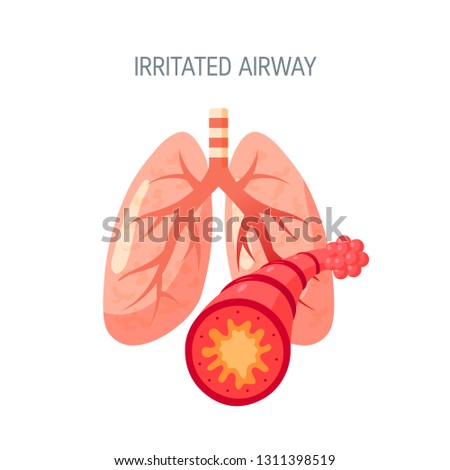 Irritated airway concept. Vector illustration in flat style for medical atlases, articles, infographics etc.
