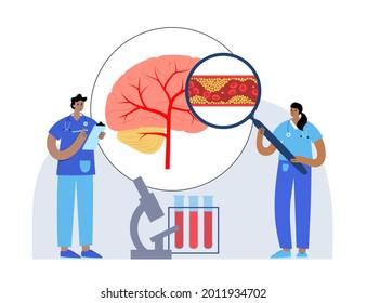 Ischemic brain stroke, arteriosclerosis. Infarct, tia, cva concept. Cholesterol in blood vessel. Fat cells in vein and artery, high ldl and hdl level. Blocked vascular concept flat vector illustration