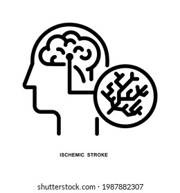 Ictus isquémico. Estilo de esquema. Aislado sobre fondo blanco.