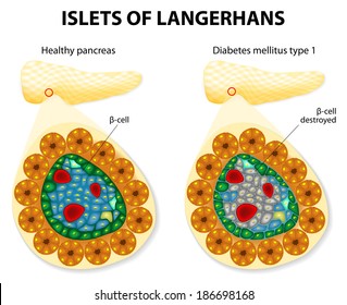  islets of Langerhans and diabetes mellitus type 1.