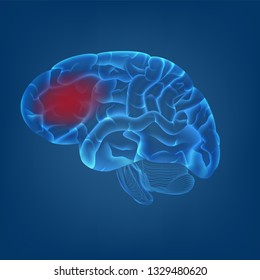 isolieren von 3D des menschlichen Gehirns mit Migräne Kopfschmerz-Bild auf digitalem, blauem Hintergrund. Konzept für MRT-Scans für die medizinische Versorgung oder für die Humankörperforschung in Vektorgrafik