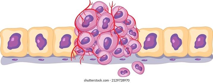 Isolated Cancer Cell On White Background Illustration