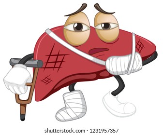 An isolated of liver damage illustration