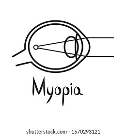 Isolated object of myopia and eye icon. Graphic of myopia and cornea vector icon for stock.