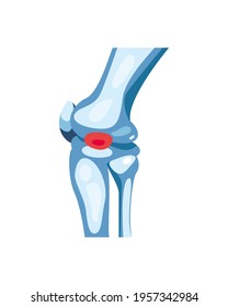 Isolated Rheumatology Blue Knee Bones