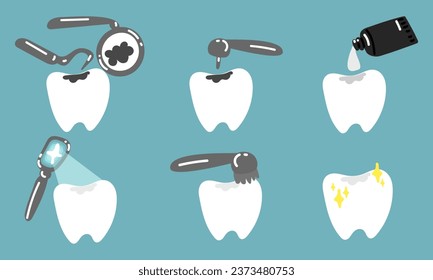 Un conjunto aislado de dientes. El proceso de remoción y llenado de caries. Tratamiento en odontología. Cita dentista. Ilustración plana vectorial sobre un fondo azul. Todas las etapas del proceso