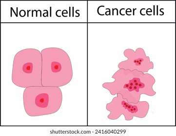 Isolated vector illustration depicting cell structures normal and cancerous. Medical diagram suitable for posters, education, and medical purposes. Can be used as a cancer icon or logo.