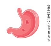 Isolated vector illustration graphic of a stomach with ulcers