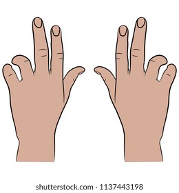 Isolated vector illustration of two human hands. Top view. Cartoon style.