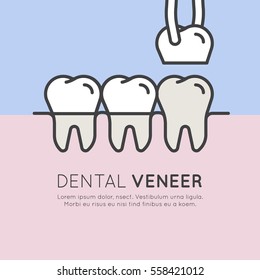 Isolated Vector Style Illustration Logo Badge or Dental Tooth Veneer Installation Process, Aesthetics, Orthodontist