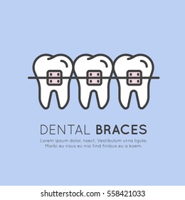 Isolated Vector Style Illustration Logo Badge or Dental Tooth Braces Installation Process, Aesthetics, Orthodontist