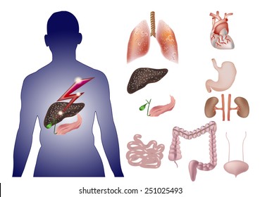 Isolates organs People suffering from pancreatitis with lightning symbol. 