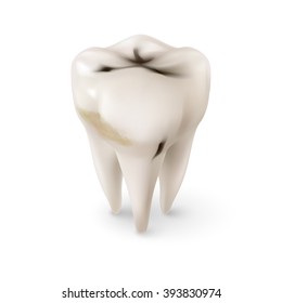 Isometric Concept of Human Tooth with Caries on White