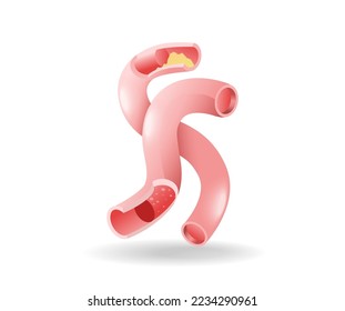 Isometric flat 3d illustration of blood vessel duct anatomy concept