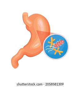 Isometric gastroenterology composition with image of stomach with helicobacteria vector illustration