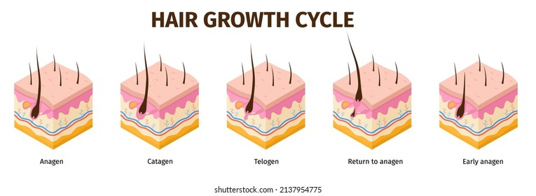 Isometric hair follicle growth cycle steps infographic. Skin anatomy medical poster. Hair grow anagen, telogen, catagen phases vector set. Different phases, human biological process