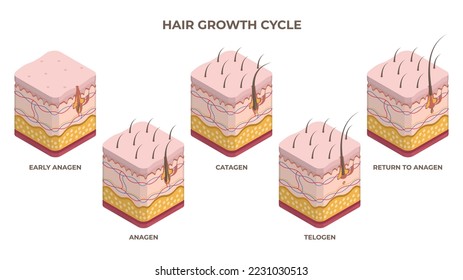 Isometric hair growth cycle, anagen, telogen, catagen phases. Human skin layers with hair follicle growth flat vector illustration set. Hair growth stages