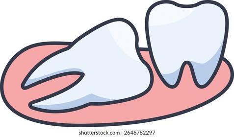 Isometric vector of an impacted wisdom tooth. Dental concept of tooth lying sideways in gum.